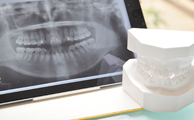 歯を失う原因の第1位「歯周病」